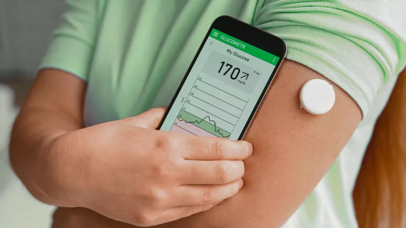 Egy inzulinpumpát viselő személy applikációval méri a vércukorszintjét.